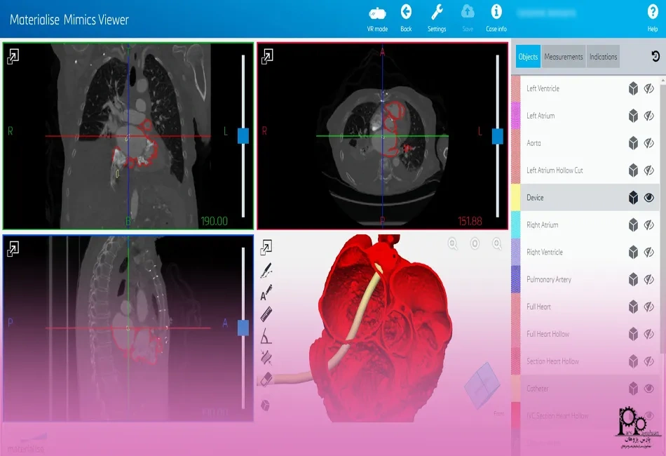 میمیکس چیست؟